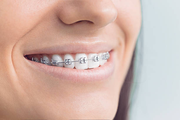 Best Traditional Braces  in Cherokee, NC
